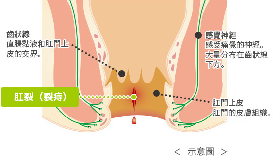 特徵是少量出血和疼痛